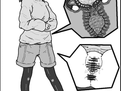 子宫寄生